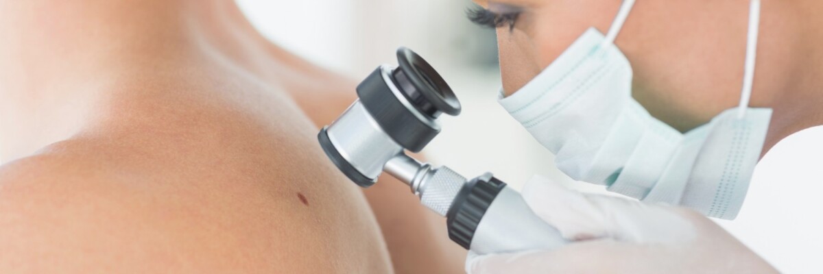 Featured image for “Concerned About Skin Cancer? Here’s What You Should be Asking Your Dermatologist”