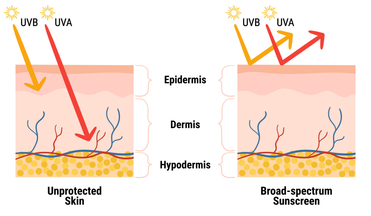 Ultraviolet (UV) Radiation - AIM at Skin Cancer Foundation