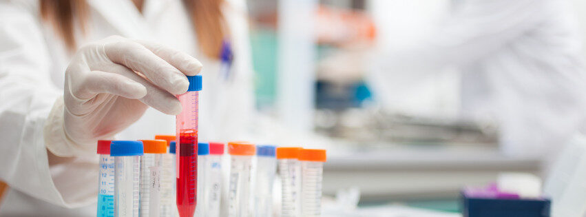 Featured image for “Trial Result Confirms the Advantage of Cemiplimab for Skin Cancer at High Risk of Recurrence”