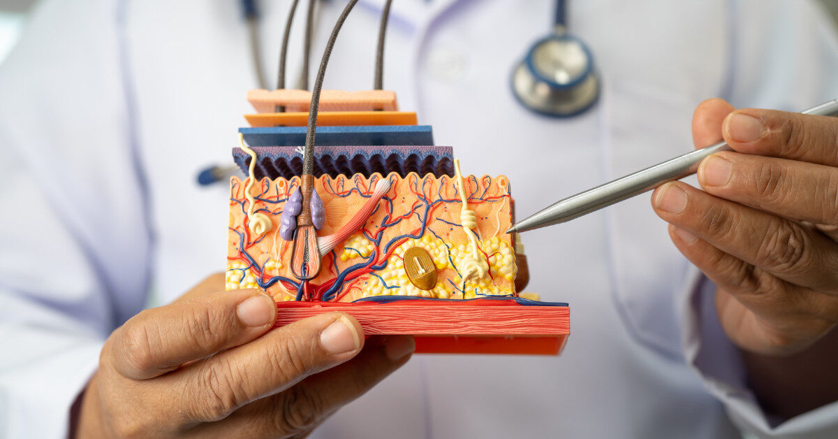 Featured image for “Understanding Merkel Cell Carcinoma: What Patients and Families Should Know”