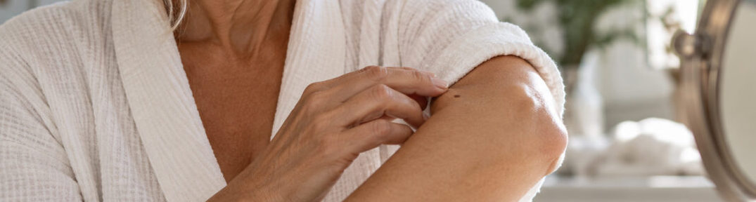 Featured image for “Introducing Question of the Month: Quick Answers to Your Skin Cancer Questions”